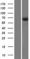 CDKAL1 Human Over-expression Lysate