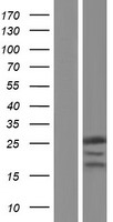 RPP25 Human Over-expression Lysate
