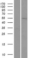 TMEM161A Human Over-expression Lysate