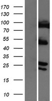 COMMD4 Human Over-expression Lysate