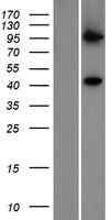 PIGV Human Over-expression Lysate