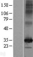 C2orf18 (SLC35F6) Human Over-expression Lysate