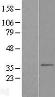 SLC25A38 Human Over-expression Lysate