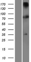 TTC12 Human Over-expression Lysate