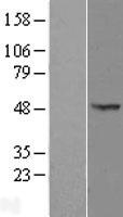 OXSM Human Over-expression Lysate