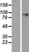DDX27 Human Over-expression Lysate