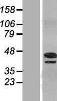 PINX1 Human Over-expression Lysate