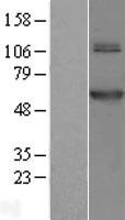 TRMT61B Human Over-expression Lysate