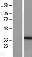 PEX26 Human Over-expression Lysate