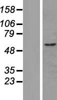 CUEDC1 Human Over-expression Lysate
