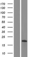 TMEM160 Human Over-expression Lysate