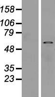 SUSD4 Human Over-expression Lysate
