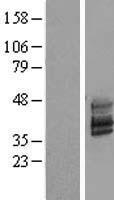 TMEM51 Human Over-expression Lysate