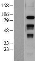 SLFN12 Human Over-expression Lysate