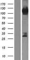 RADIL Human Over-expression Lysate
