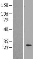 CEP27 (HAUS2) Human Over-expression Lysate