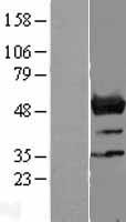 NLE1 Human Over-expression Lysate