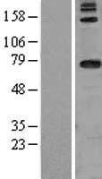 DARS2 Human Over-expression Lysate