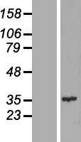 CENPQ Human Over-expression Lysate