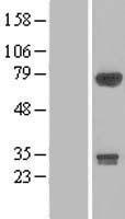 DIP13B (APPL2) Human Over-expression Lysate