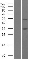 BTBD7 Human Over-expression Lysate