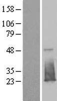 FAM176B (EVA1B) Human Over-expression Lysate