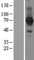 NAD Synthetase (NADSYN1) Human Over-expression Lysate