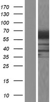 RIC8 (RIC8B) Human Over-expression Lysate