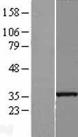 SLC25A36 Human Over-expression Lysate