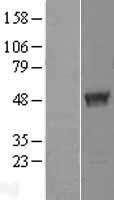 TBC1D13 Human Over-expression Lysate