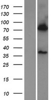 BBS7 Human Over-expression Lysate