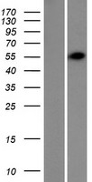 TRIM62 Human Over-expression Lysate