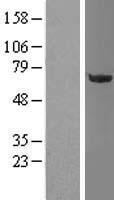 OGFOD1 Human Over-expression Lysate