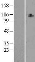 CCDC87 Human Over-expression Lysate
