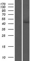 Acylglycerol Kinase (AGK) Human Over-expression Lysate