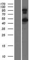 CCDC91 Human Over-expression Lysate