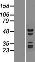 RBM41 Human Over-expression Lysate