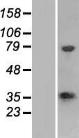 CSTP1 (CPPED1) Human Over-expression Lysate