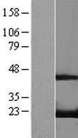 RFK Human Over-expression Lysate