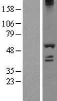 DDX19A Human Over-expression Lysate