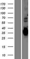 TMEM74B Human Over-expression Lysate