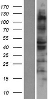 RSAD1 Human Over-expression Lysate
