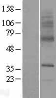 SLC29A3 Human Over-expression Lysate