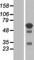 TCP11L1 Human Over-expression Lysate