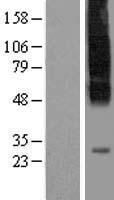 SLC35C1 Human Over-expression Lysate