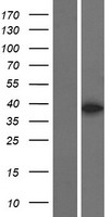 MBNL3 Human Over-expression Lysate