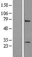 LRP2BP Human Over-expression Lysate