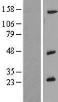 IL26 Human Over-expression Lysate