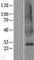 SLC39A9 Human Over-expression Lysate
