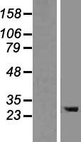 TMEM106B Human Over-expression Lysate